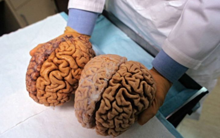 Правда ли, что человеческий мозг может работать только на 10% от имеющихся ресурсов 